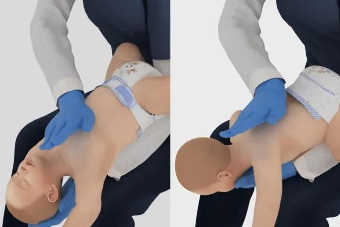 (Foto: American Heart Association (AHA)/Circulation Magazine / Reprodução)