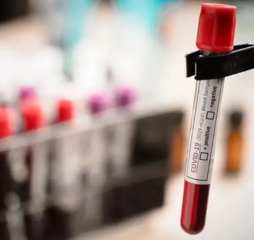Com apenas uma coleta de sangue, o novo exame pode detectar sinais específicos de câncer antes do aparecimento de sintomas. (Foto: Chokniti Khongchum/Shutterstock)