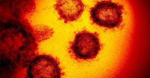 Imagem de microscópico mostra o novo coronavírus, responsável pela doença chamada Covid-19. (Foto: Reprodução/NIAID-RML/AP)