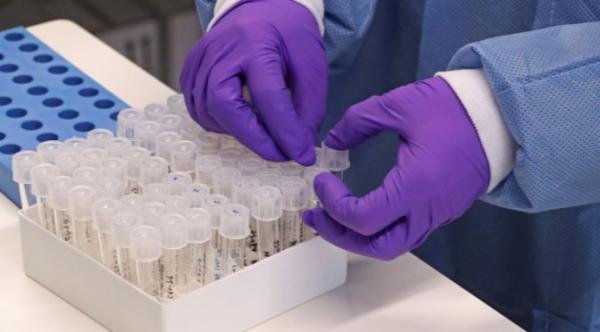 De acordo com a SES-RS, casos de Covid-19 já foram diagnosticados em 48 cidades gaúchas, totalizando 254 contaminados (Foto: Reprodução/Agência Brasil)