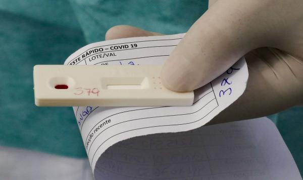 Em relação às mortes por Covid-19, os maiores acréscimos nas duas últimas semanas ocorreram no Sul (36%)