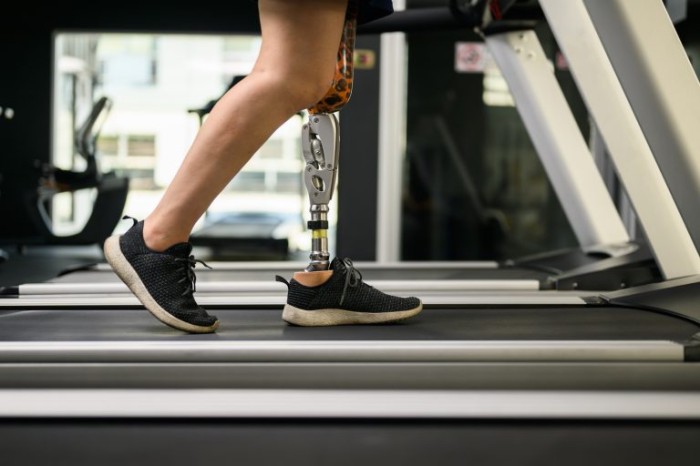 Perna robótica é um exemplo de tecnologia assistiva - (Foto: Ton Photograph/GettyImages)